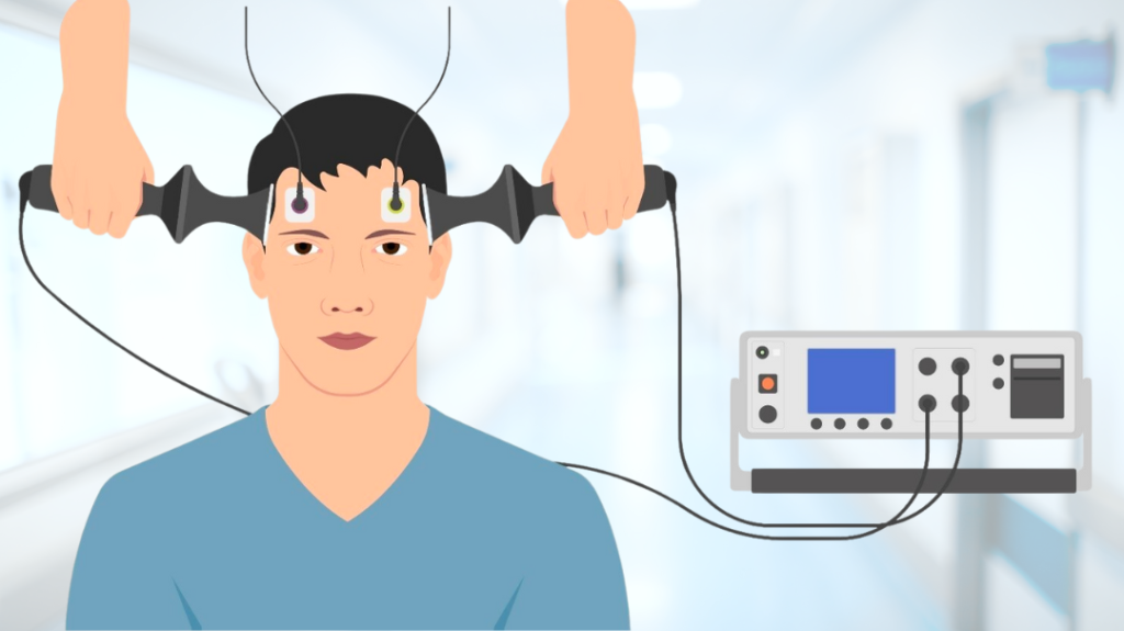 Medical illustration of a patient undergoing a brain stimulation treatment session, such as ECT or TMS, at a clinic.